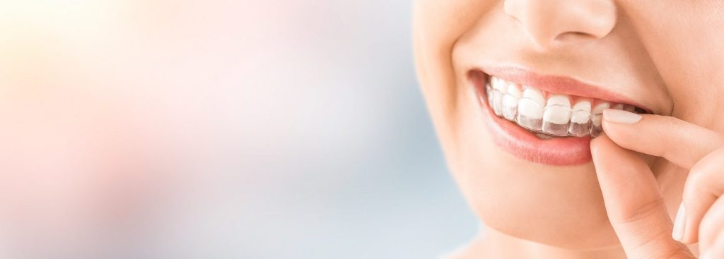 Ma Phase Invisalign Invisalign Brockton MA, Straighten Teeth