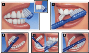 Visual guide on how to brush your teeth